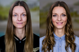 ditte vorher nachher